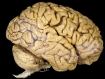 Creierul – corpul uman organe interne