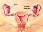 Ovarul – anatomie