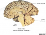 Imagini creierul uman