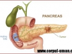 Ce ar trebui sa mananci ca sa previi cancerul pancreatic?
