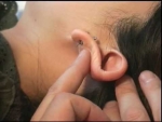 Cum poti trata tiuitul din urechi?