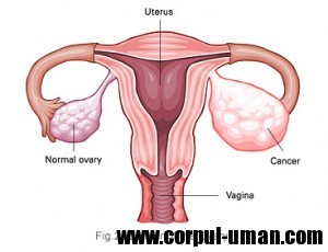 Test cancer ovarian