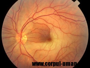 Imbunatatirea vederii cu luteina