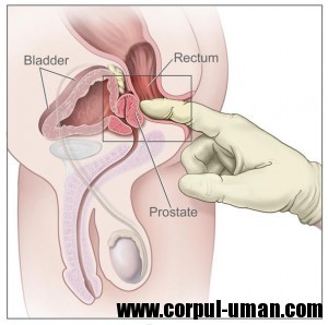 Tratament inovator pentru prostata mărită