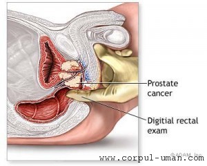 Rak prostate - kako ga prepoznati i kako liječiti