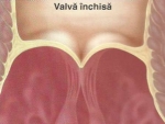 Valvele aortice şi pulmonare – Anatomie Umana