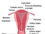 Histeroscopia – Endocolul, Endometrul si orificiile tubare