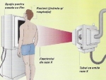 Cum se fac radiografiile toracice