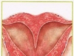 Uter – Structura uterului, vascularizatia uterului, limfaticele si inervatia