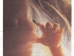 Etapele dezvoltarii embrionului uman