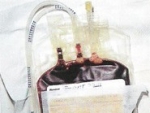 Donarea de sânge din cordonul ombilical