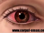 Inflamatiile ochiului