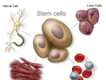 O noua descoperire in tratamentul cu celule stem