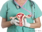 Menstruatia neregulata, asociata cu riscul de a face cancer ovarian?