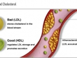 Cum cresteti colesterolul bun, HDL?