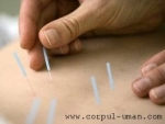 Cat de utila este acupunctura pentru tratarea unor alergii?