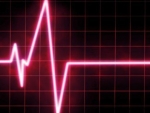 Riscul colericilor de a face infarct