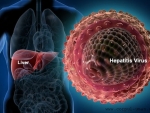 Cum te afecteaza virusurile hepatice?