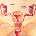 Anatomia ovarului