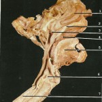 Sectiune sagitala prin cavitatea nazala, bucala, faringe, laringe, trahee si esofag