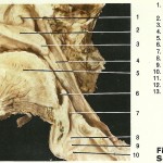 Sectiune sagitala in cavitatea bucala