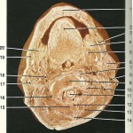 Sectiune orizontala cavitatea bucala