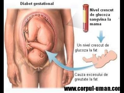 Diabetul gestational