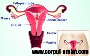 Cancer uterin