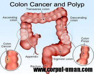 Cancer de colon - diagnosticare